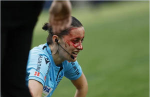 Bandeirinha bate cabeça contra câmera em jogo da LALIGA